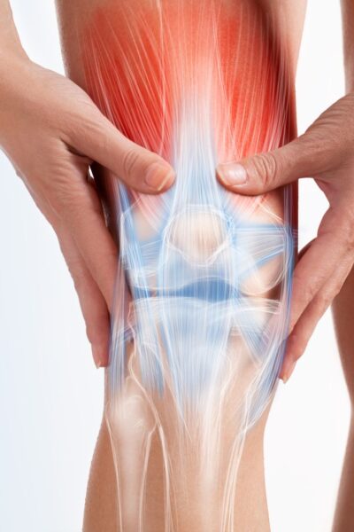 צמחי מרפא לטיפול באוסטאוארטריטיס- Osteoarthritis